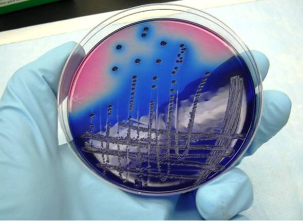 ureaplazma ili kako najmanja bakterija može uzrokovati sterilitet